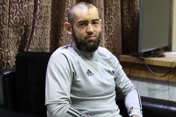 "Şah"la Portuqaliyaya qarşı çıxışından zədələrədək səmimi söhbət: "Allah çox qorudu məni - gözsüz qala, hətta ölə bilərdim"