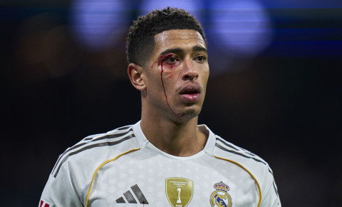 Jud Bellingemin qaşı partlasa da oyunu davam etdirib